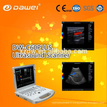 Doppler de couleur d&#39;écho de base pour le système diagnostique d&#39;ultrason de Doppler de cardiologie et d&#39;échocardiographie 3D
